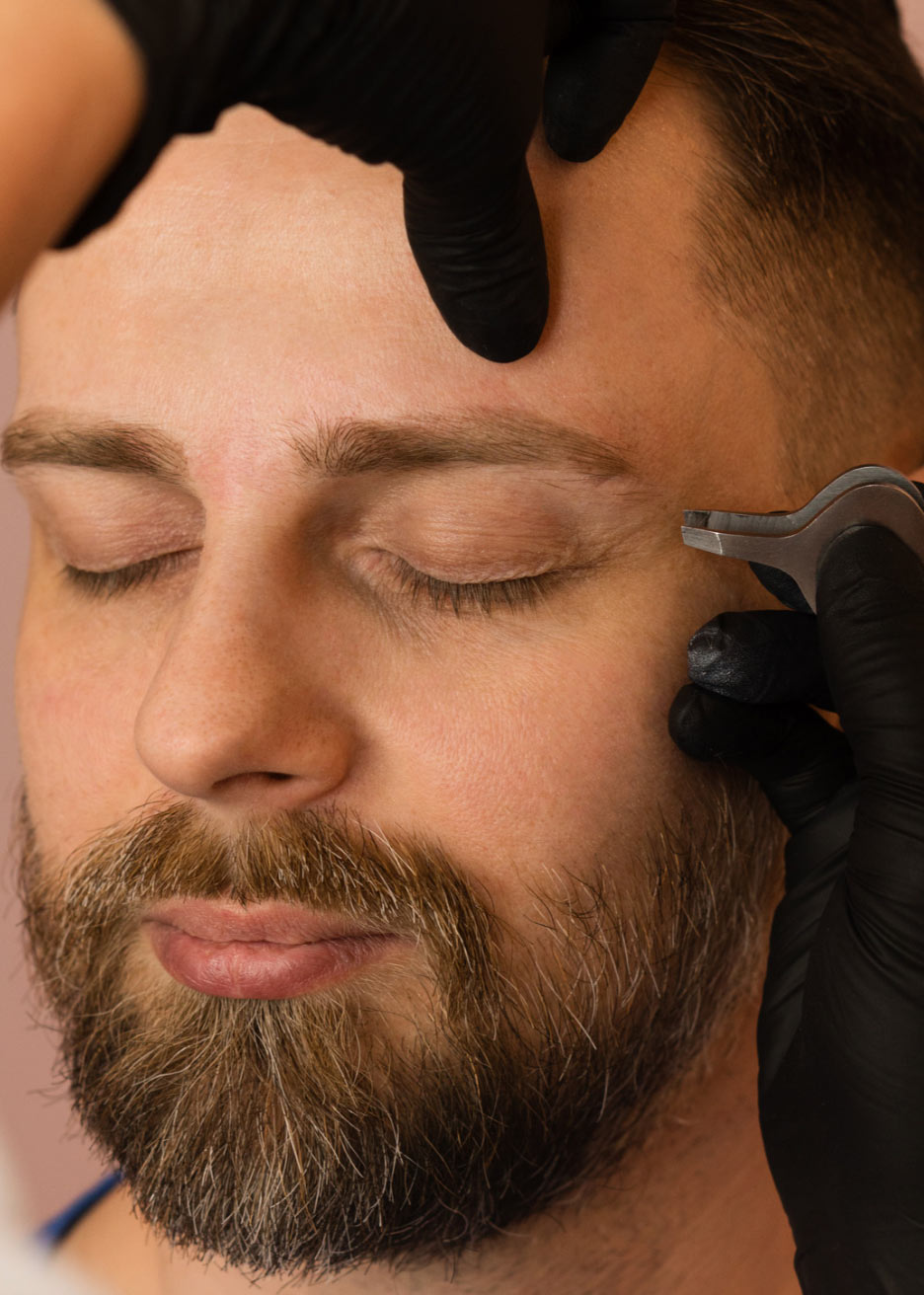 Person with closed eyes getting groomed or examined by gloved hands, using a tool near the eyebrow.